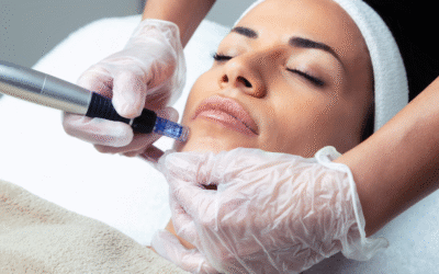 Dermapen (Microneedling)