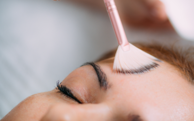 Tratamiento para las Manchas (Paquete de 4 Sesiones)